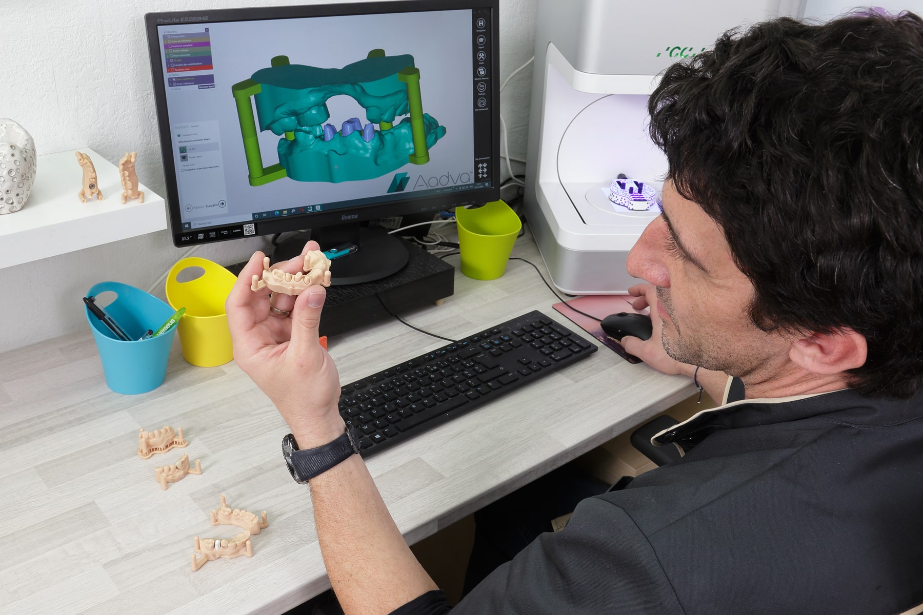 Blanc Ceram, Cabinet de prothésiste dentaire, vision d'empreinte en 3D, moulage